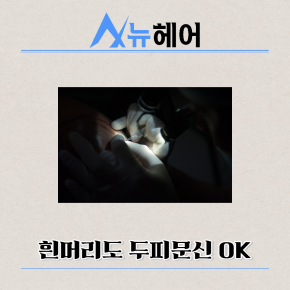 남자두피문신 정수리탈모 완벽한 커버 관련 이미지 6