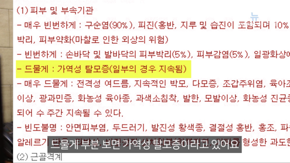 로아큐탄 여드름약 부작용이 탈모? 모발이식하고 탈모약을 먹는다면... 관련 이미지 3
