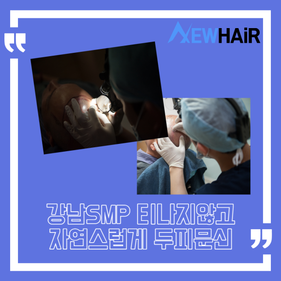 강남SMP 티나지않고 자연스럽게 두피문신 관련 이미지 1