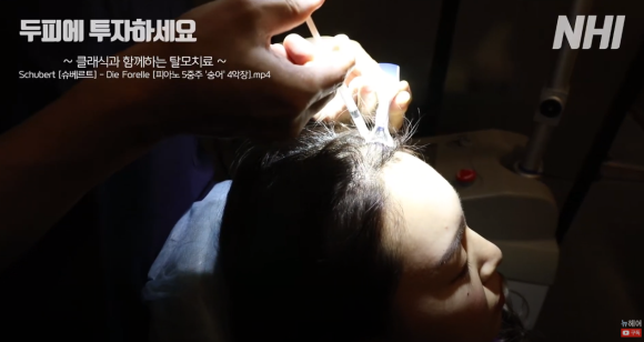 새로운 탈모치료? 머리숱 플렉스하는 FLEEX 치료 l 모낭주사 관련 이미지 7