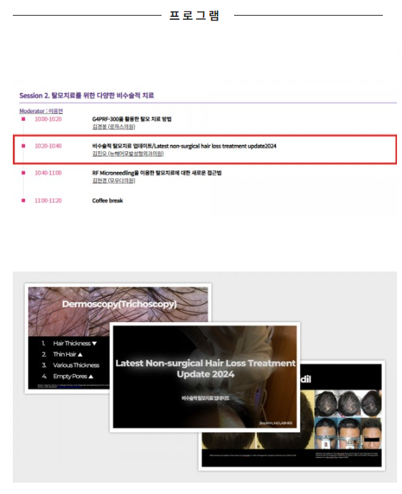 2024년 9월 대한미용성형레이저의학회 미용의료기기 박람회 및 추계학술대회 발표 관련 이미지 5