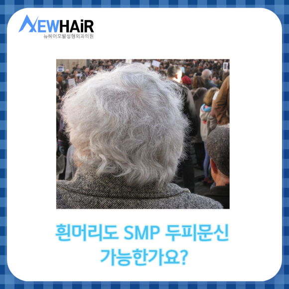 SMP 두피문신 자연스럽게 탈모커버 관련 이미지 2