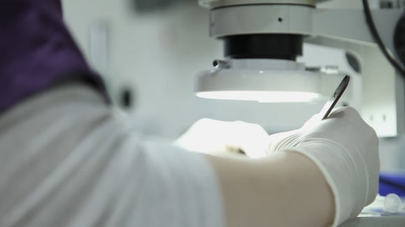 모발이식 때 모낭 저장액으로 혈장(plasma) 사용 시 유용성 관련 이미지 4