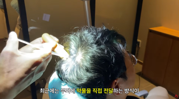 탈모 모낭주사 효과 진짜 있나요? (종류&middot;부작용) 관련 이미지 2