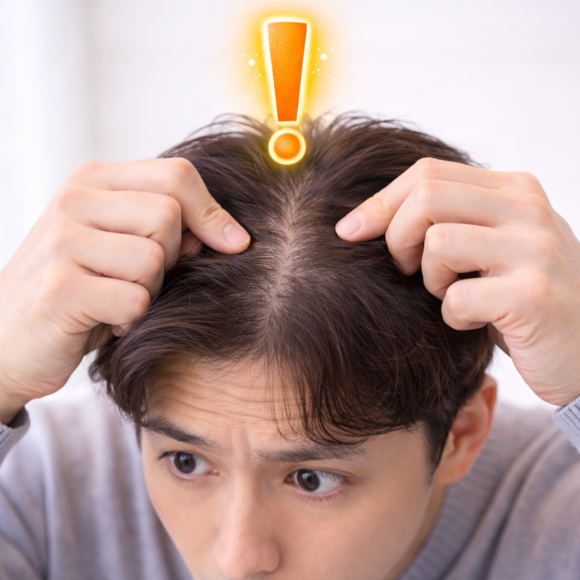 여자탈모검사 모발이식 전 어떻게 이루어지나요? 관련 이미지 5