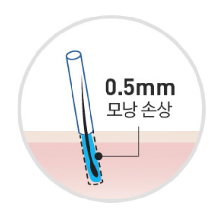 비절개 모발이식 흉터, 줄일 수 있는 노하우 1가지 관련 이미지 4