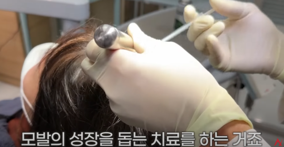 항암치료 후 탈모 극복, 이렇게 탈모치료하세요(탈모약, 영양제, 주사) 관련 이미지 9