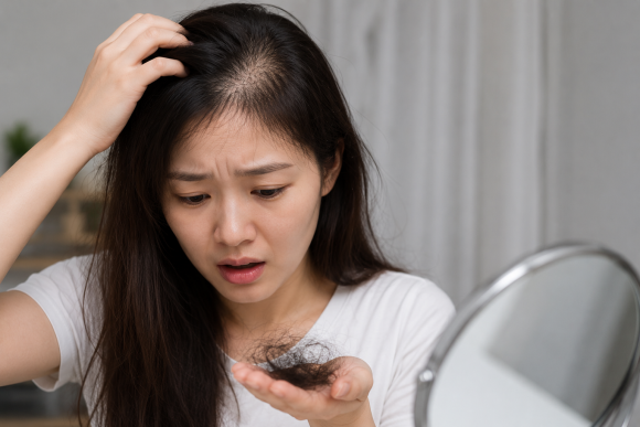 Sudden Hair Loss After Dieting? FAQ on Nutritional Deficiency–Related Hair Loss image 3