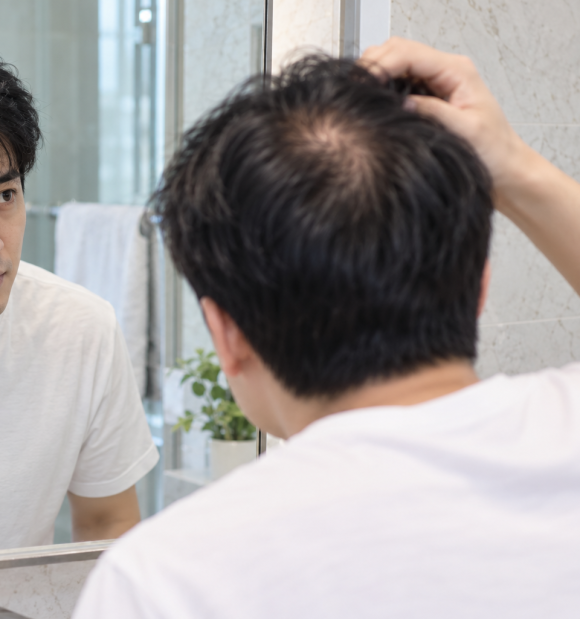 탈모약 끊으면 더 빠지나요? 안드로겐 수용체와 따라잡기 탈모 관련 이미지 2