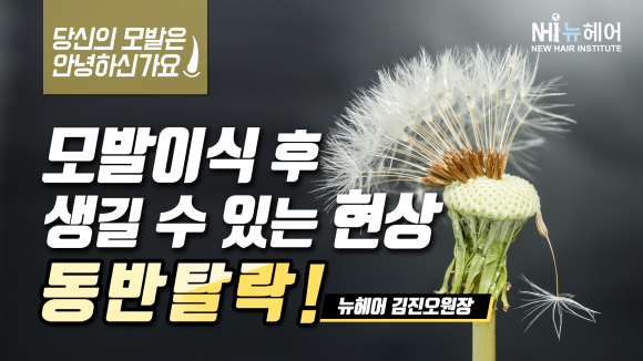 모발이식 후 동반 탈락이란? 관련 이미지 1