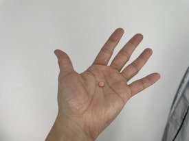 탈모약, 가장 자주 묻는 질문 2가지 정리(효과와 부작용) 관련 이미지 3