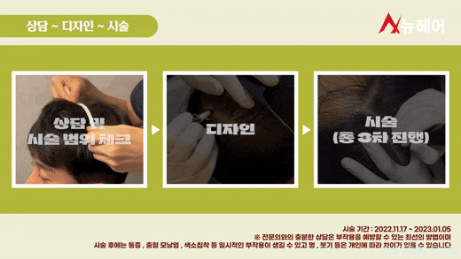 정수리두피문신 리얼 후기! 두피문신은 이런분들에게 추천합니다. 관련 이미지 5