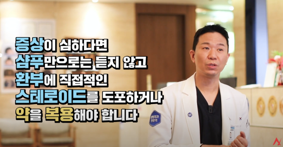 두피 지루성 피부염(지루성 두피염), 탈모로 이어지기 전 이렇게 관리하길 관련 이미지 5