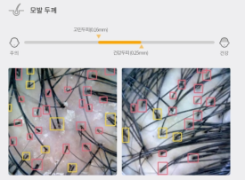 홍삼 캔디로 탈모치료 한다...? 관련 이미지 4