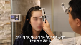 Improving an M-Shaped Hairline: Which Hairline Looks Natural? image 1