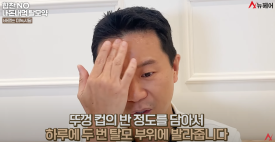 탈모약, 가장 자주 묻는 질문 2가지 정리(효과와 부작용) 관련 이미지 8