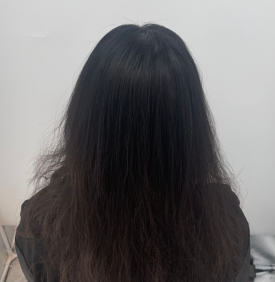 SMP후기, 두피문신 받고 자신감 회복한 30대 여성분 사례 관련 이미지 11