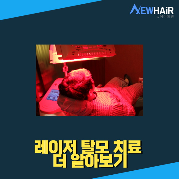 강남탈모 치료 정확히 알아보고 관련 이미지 3