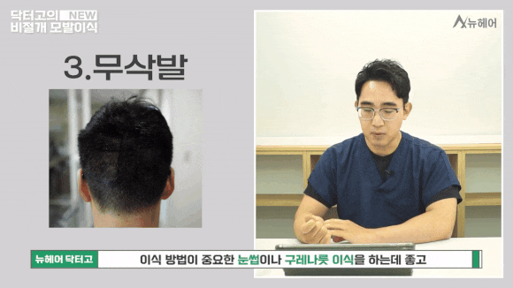 비절개모발이식 종류와 선택 가이드 관련 이미지 4