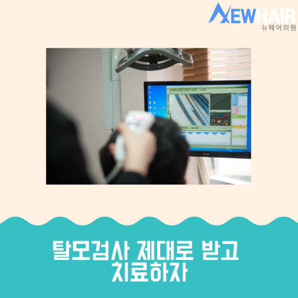 탈모검사 제대로 받고 치료하자 관련 이미지 1