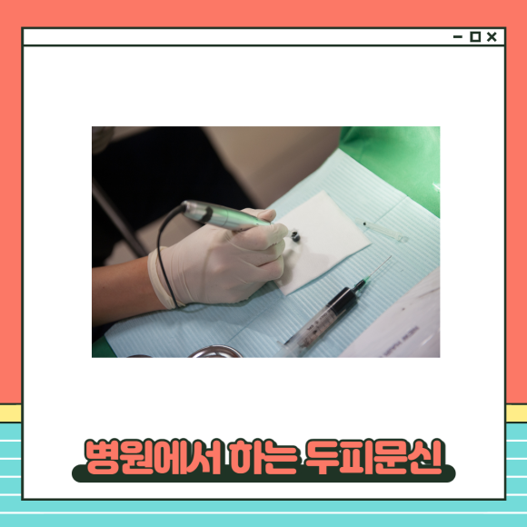 정수리 가르마두피문신 수술없이 탈모해결 관련 이미지 5