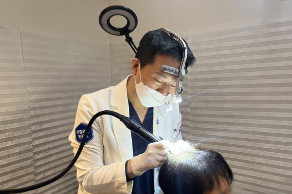 5 Cases When SMP Scalp Micropigmentation Is Needed image 3