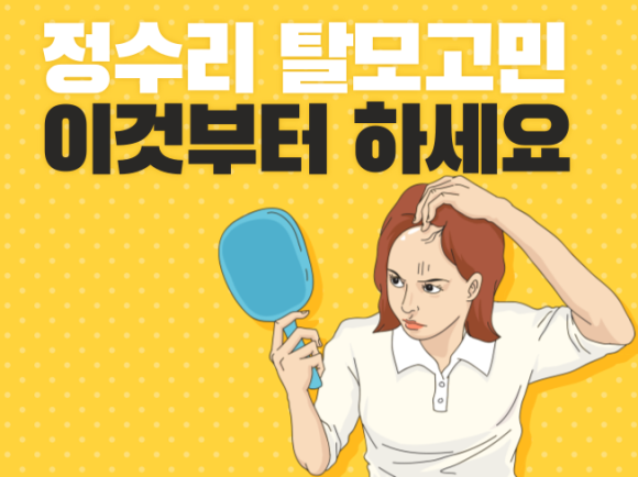 정수리 탈모고민 이것부터 하세요 관련 이미지 1