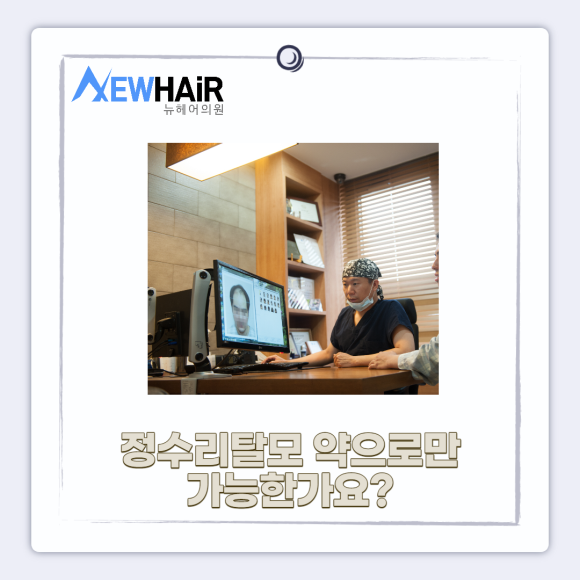 정수리탈모 관리 방법 알아보기 관련 이미지 4