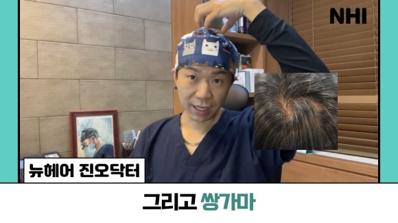 모발이식, 쌍가마에도 가능할까? ㅣ모발이식 제비추리 관련 이미지 3