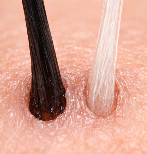 Why Do Gray Hairs Appear First Only at the Sideburns? Is There Really a Separate Reason? image 3