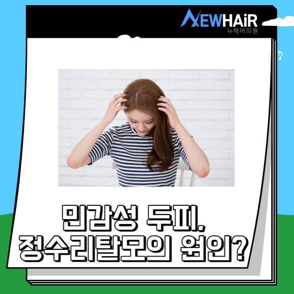 정수리탈모치료 더 늦지 않게 관련 이미지 2
