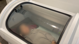산후탈모, 관리와 상담이 필요한 시점은 언제일까요? 관련 이미지 5