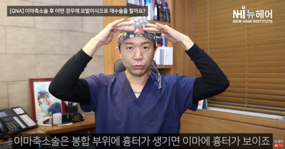 이마축소술했지만 모발이식 재수술하는 경우 ㅣ헤어라인교정 ㅣ 이마축소술 흉터 관련 이미지 3