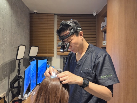 정수리 탈모 초기? 증상과 원인 그리고 치료 방법 관련 이미지 4