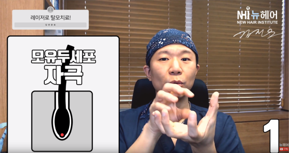 탈모 레이저 &middot; 헤어빔 치료 효과와 부작용 관련 이미지 2