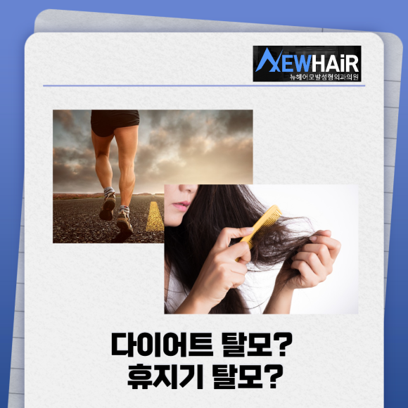 탈모주사치료 다이어트탈모 해결하기 관련 이미지 2