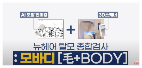 서울탈모병원? 방문 전 2가지만 확인해 보세요 관련 이미지 2