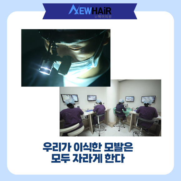여름모발이식 부작용 생긴다? 관련 이미지 5