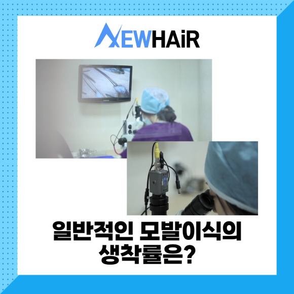 모발이식 생착률 걱정이라면 관련 이미지 3