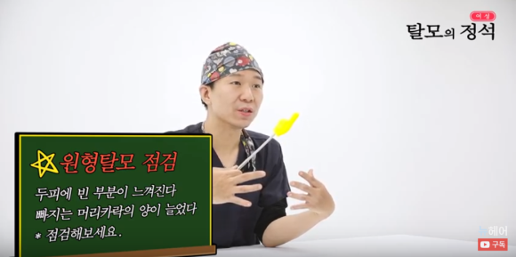 원형 탈모 진단법 l 원인 l 치료법 l 스트레스 탈모 관련 이미지 2