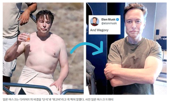 위고ㅇ 다이어트 약, 날씬해지지만 탈모 위험이? 관련 이미지 3
