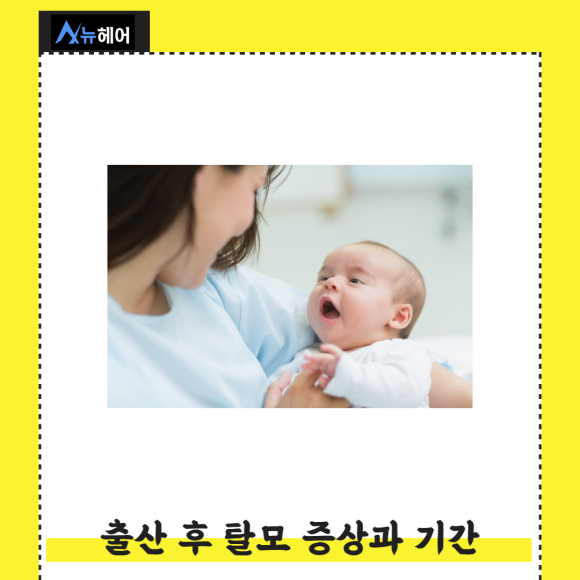 출산 여성탈모 빠른 회복방법은? 관련 이미지 3