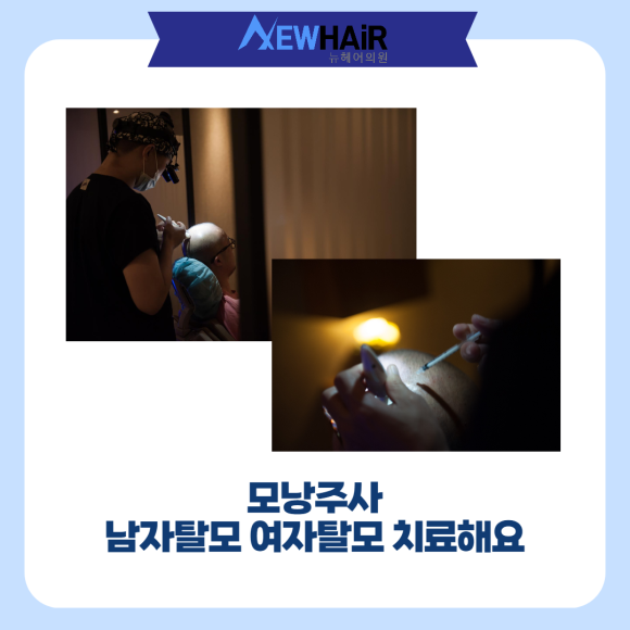모낭주사 남자탈모 여자탈모 치료해요 관련 이미지 1