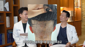 A Complete Guide to Non-Incisional Hair Transplant Methods image 3