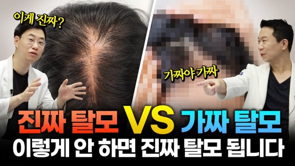 탈모 진단 병원, 초기 증상과 예방법 정리 관련 이미지 8