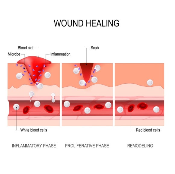 How to Increase Hair Transplant Graft Survival: Key to Recovery Without Scars image 1