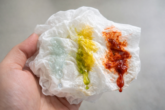 하얀 콧물, 노란 콧물, 초록(붉은, 검은) 콧물이 나오는 이유 관련 이미지 1