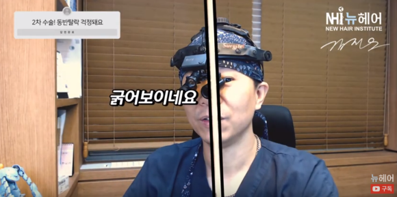 모발이식 2차 수술 실패 이유? 동반탈락 시기 관련 이미지 2