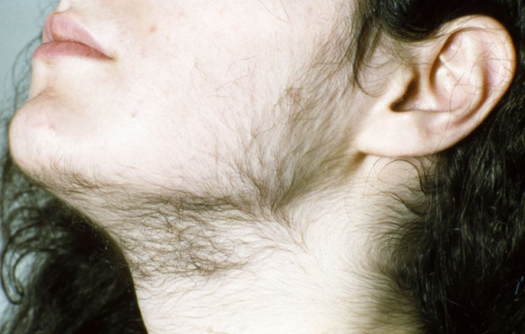 Could Electrical Stimulation Hair Loss Treatment Become a New Key to Hair Regeneration? image 2