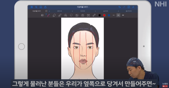 [뉴헤어] 성형외과 의사가 알려주는 이상적인 헤어라인 비율 관련 이미지 6
